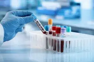 aumento de casos de VIH en Chicago y acceso a salud en comunidad latina